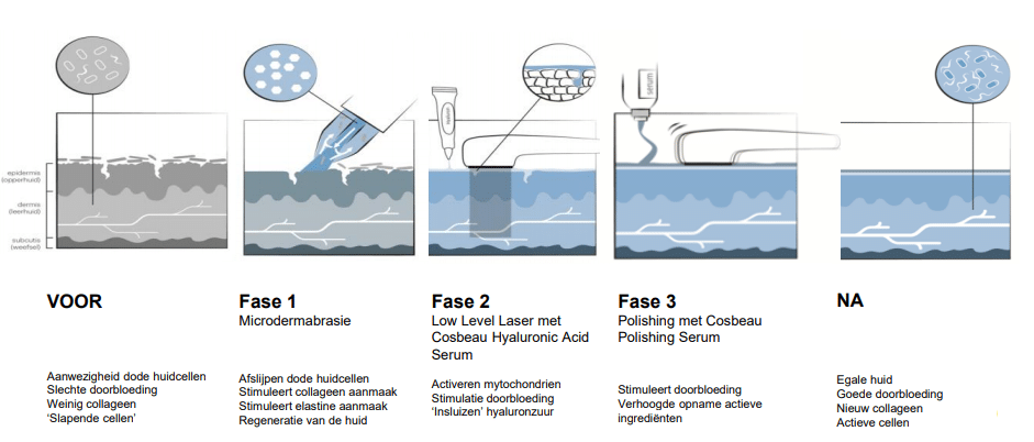 Cryolipolyse